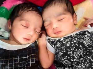 Miracle Babies 3 miracle baby ivf success ivf twins test tube baby ranchi jamshedpur dhanbad jharkhand